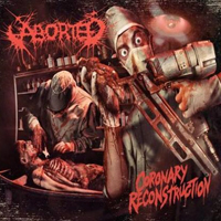 Aborted - Coronary Reconstruction