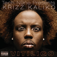 Krizz Kaliko - Vitiligo
