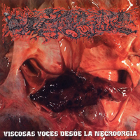 Paracoccidioidomicosisproctitissarcomucosis - Viscosas Voces Desde La Necroorgia