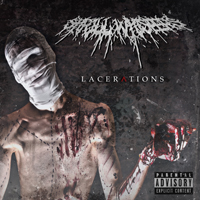 Shrill Whispers - Lacerations