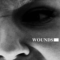 Une Misere - Wounds (Single)