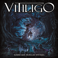 Vitiligo - Sobre Mis Huellas Viviras