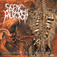 Septic Autopsy - Spontaneous Emanation Of Rotting Smell Through Necropsy Process