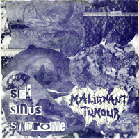 Malignant Tumour - Riot - Sick Sinus Syndrome [Split EP]